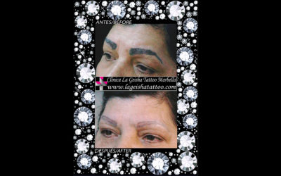 Magic eyebrows micropigmentation removal in just one session